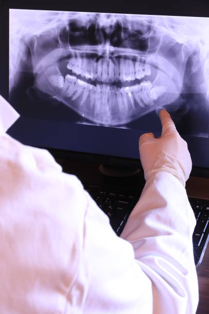 Best Root Canal Emergency Dentist  in Dawson, GA